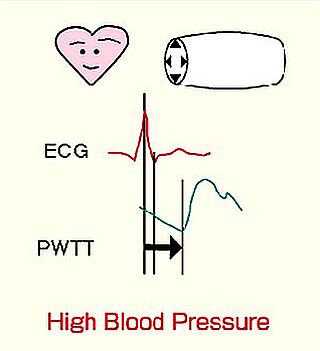 high bloood pressure ayurvedic treatment
